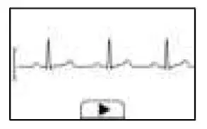 viatom-PD-30092-Checkme-Lite -Health-Monitor-fig11