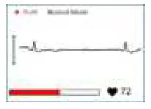 viatom-PD-30092-Checkme-Lite -Health-Monitor-fig19