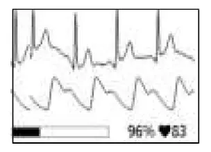 viatom-PD-30092-Checkme-Lite -Health-Monitor-fig6