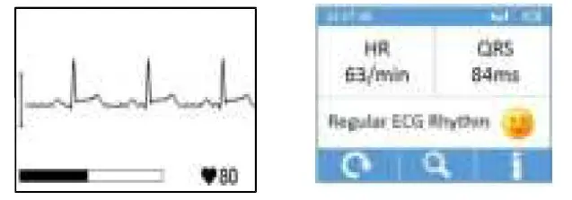 viatom-PD-30092-Checkme-Lite -Health-Monitor-fig8