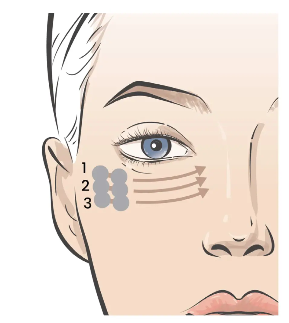 TENS-K-UNIWAND Target Fine Lines and Wrinkles for a Non-Invasive Facelift - Eye