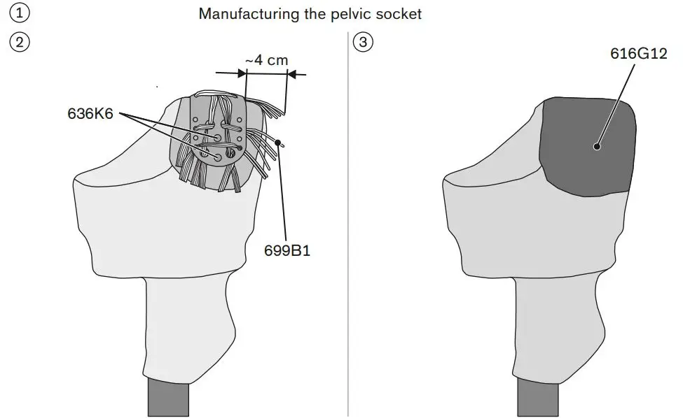 ottobock 7E8 Walking Prosthetic Hip Joint Instructions - Bench alignment of the prosthesis