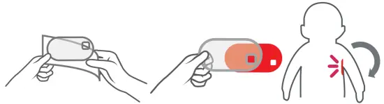 Attach the thermometer