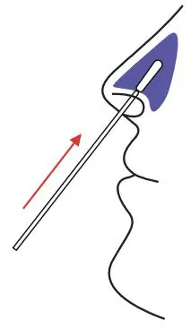 Speedy Swab Rapid COVID-19 Antigen Self-Test Instruction Manual - Swab both nostrils carefully