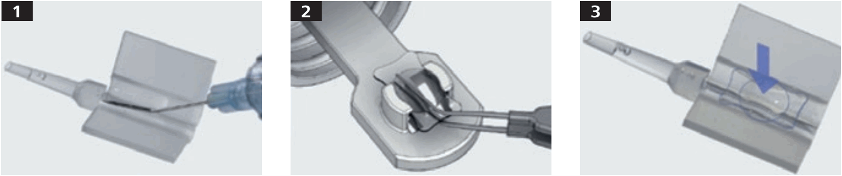 ZEISS A6 Single Use Injector with AT Smart Cartridge Set - fig