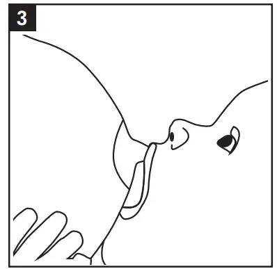 medela SNS Supplemental Nursing System Fig-3