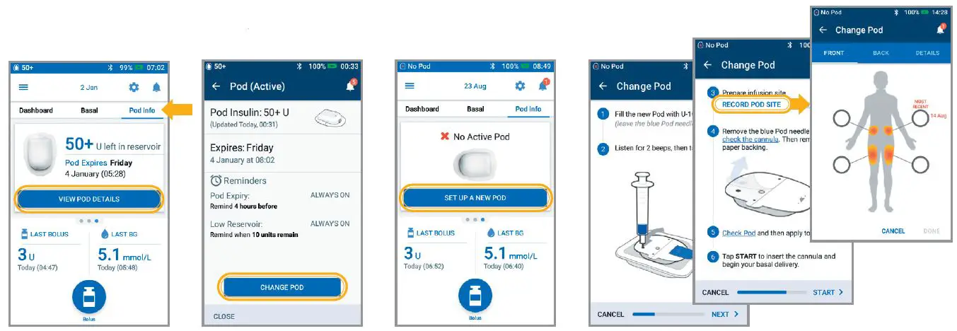 omnipod DASH Podder Insulin Management System fig6
