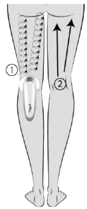 PROJECT E BEAUTY PE142 LED RF Ultrasonic Slimming Device - fig 1