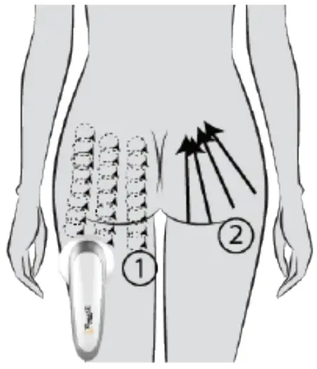 PROJECT E BEAUTY PE142 LED RF Ultrasonic Slimming Device - fig 3