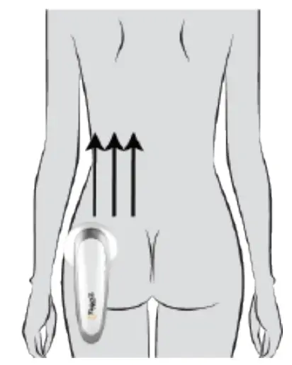 PROJECT E BEAUTY PE142 LED RF Ultrasonic Slimming Device - fig 6