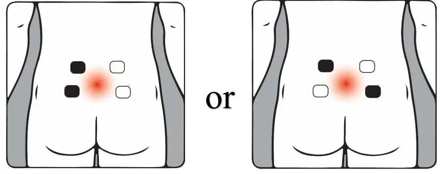 YU-UNIVERSE-Transcutaneous-Electrical-Nerve-Stimulator-FIG-3
