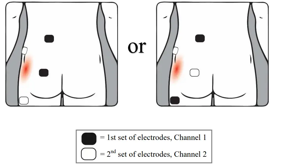 YU-UNIVERSE-Transcutaneous-Electrical-Nerve-Stimulator-FIG-4