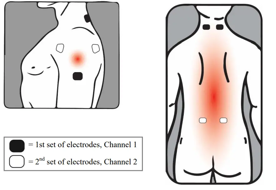 YU-UNIVERSE-Transcutaneous-Electrical-Nerve-Stimulator-FIG-7
