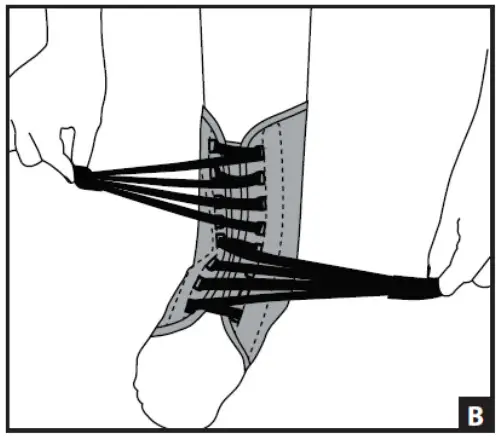 DJO Stabilizing PRO - fig 2
