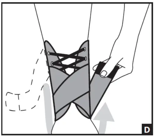 DJO Stabilizing PRO - fig 4