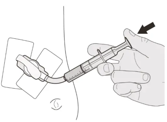 EVRYSDI dose through gastrostomy tube