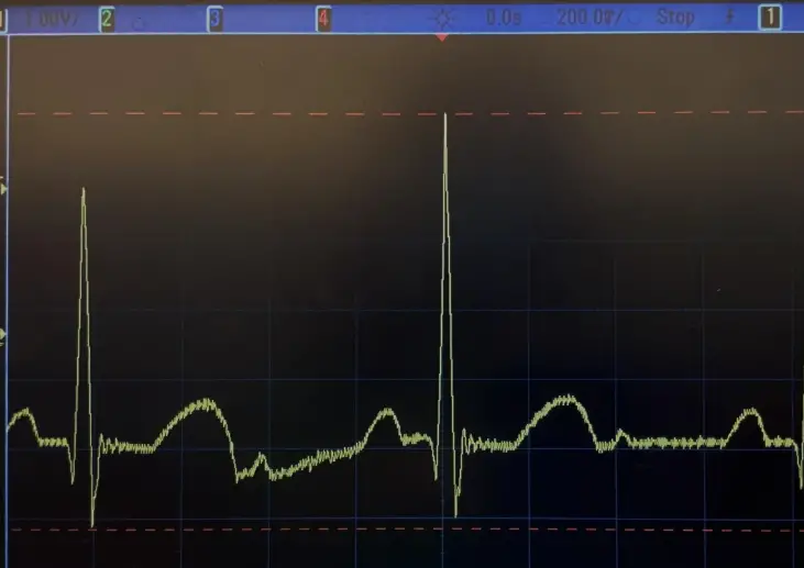instructables-Design-a-Functional-ECG-With-Automated-Plotting-of-the-Biosignal-product-image