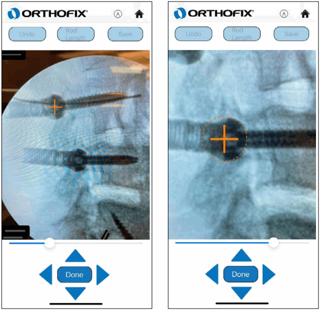 ORTHOFIX OFIX MIS App Workflow - Appendix