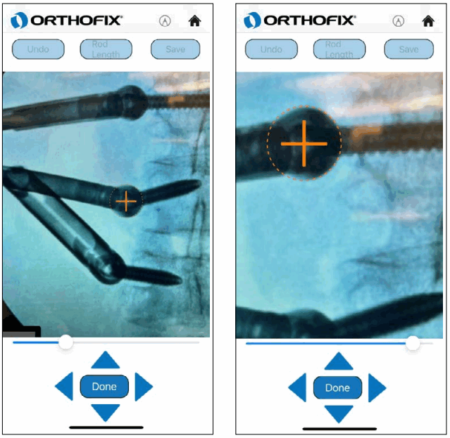 ORTHOFIX OFIX MIS App Workflow - Calibration with AP