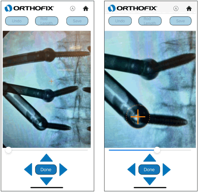 ORTHOFIX OFIX MIS App Workflow - Calibration