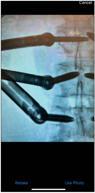 ORTHOFIX OFIX MIS App Workflow - Image Capture