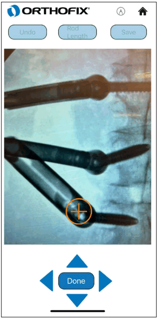 ORTHOFIX OFIX MIS App Workflow - Marker 1