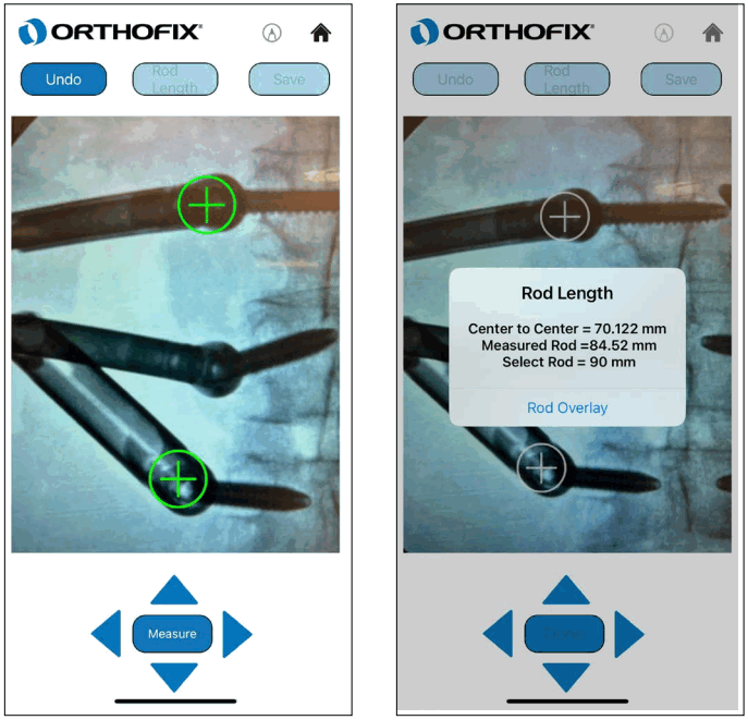 ORTHOFIX OFIX MIS App Workflow - Measure