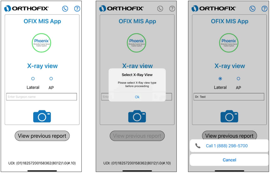 ORTHOFIX OFIX MIS App Workflow - Surgery Info