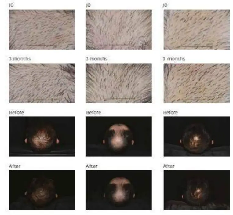 REGENSIFY DHT Blocking Shampoo fig 2