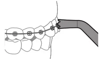 PHILIPS 2000 Series Sonicare Cordless Power Flosser - Cleaning Orthodontic Brackets with the Quad Stream 1