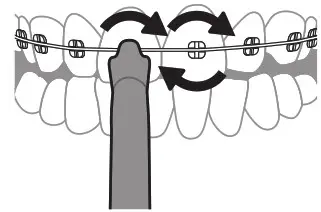 PHILIPS 2000 Series Sonicare Cordless Power Flosser - Cleaning Orthodontic Brackets with the Quad Stream 2
