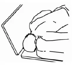 INVACARE-5411IVC-Full-Electric-Bed-fig-7