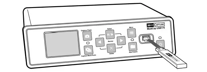 acmerevival USB170 Medical Still Image Recorder-4
