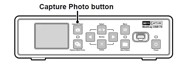 acmerevival USB170 Medical Still Image Recorder-5