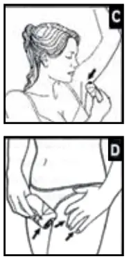 REMINGTON Body Face Epilator - YOUR EPILATOR 2