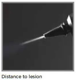 HO CryoPen &amp CryoProbe Series - Effective application2