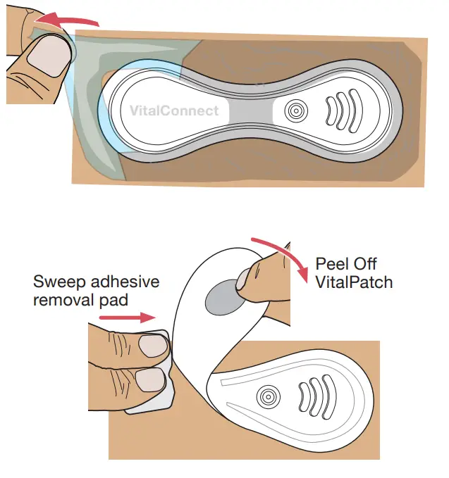 VitalConnect MKT 161 Cardiac Monitoring - fig 1