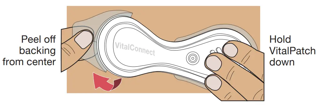 VitalConnect MKT 161 Cardiac Monitoring - fig 6