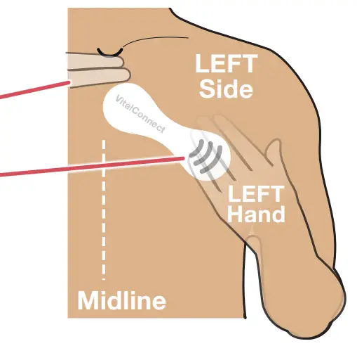VitalConnect MKT 161 Cardiac Monitoring - fig 7