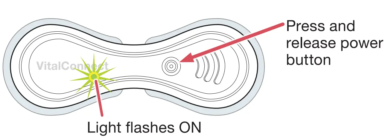 VitalConnect MKT 161 Cardiac Monitoring - fig 8