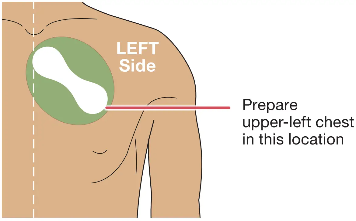 VitalConnect MKT 161 Cardiac Monitoring - fig 9
