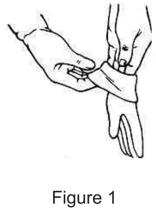 Screen Material Installation