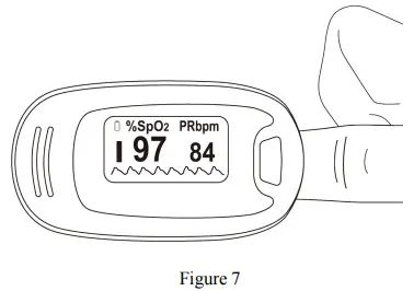 CONTEC CMS50NA Pulse Oximeter - Operating Guide