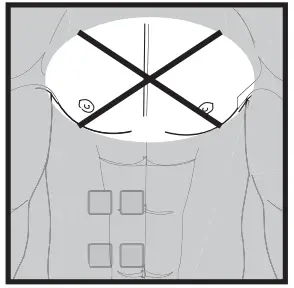 beurer EM 59 Digital TENS-EMS Unit with Heat Function - fig 1