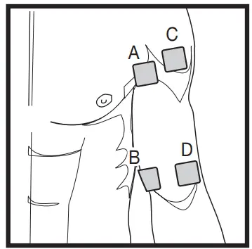 beurer EM 59 Digital TENS-EMS Unit with Heat Function - fig 5