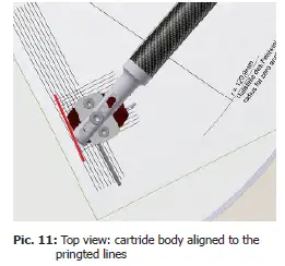 clearaudio-Emotion-SE-2-Speed-Belt-Drive-FIG-13