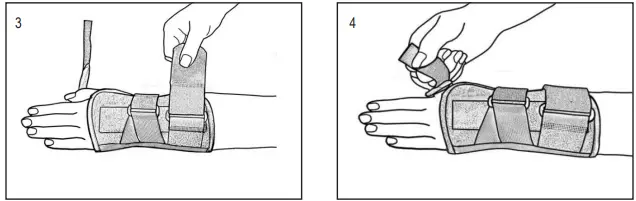 HELY-WEBER-438 Universal-Wrist Orthosis-FIG-2