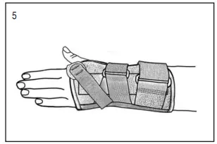 HELY-WEBER-438 Universal-Wrist Orthosis-FIG-3