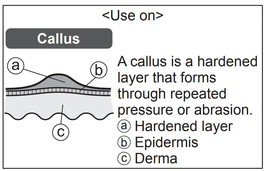 Callus