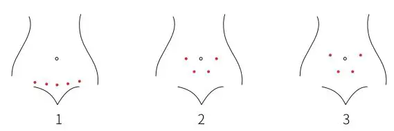 Babytone P600L Baby Heartbeat Monitor 5